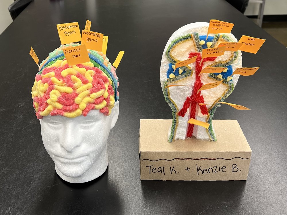 Candy Brain — Kenzie and Teal